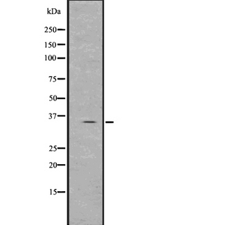 SRM / Spermidine Synthase Antibody - Western blot analysis of Spermidine using Jurkat whole lysates.