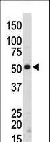 SRMS Antibody - The anti-SRMS antibody is used in Western blot to detect SRMS in mouse kidney tissue lysate.