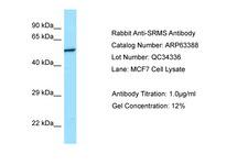 SRMS Antibody -  This image was taken for the unconjugated form of this product. Other forms have not been tested.