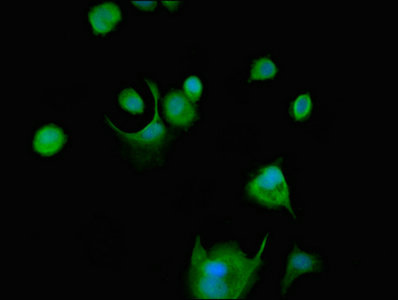 SRMS Antibody - Immunofluorescent analysis of MCF-7 cells at a dilution of 1:100 and Alexa Fluor 488-congugated AffiniPure Goat Anti-Rabbit IgG(H+L)