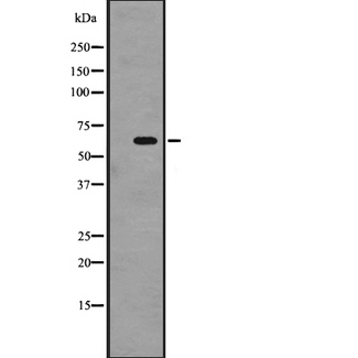 SRMS Antibody - Western blot analysis of SRMS expression in A431 whole cells lysate. The lane on the left is treated with the antigen-specific peptide.