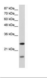 SRP14 Antibody - HepG2 Cell Lysate.  This image was taken for the unconjugated form of this product. Other forms have not been tested.