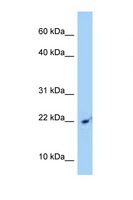 SRP14 Antibody - SRP14 antibody Western blot of Jurkat Cell lysate. Antibody concentration 1 ug/ml.  This image was taken for the unconjugated form of this product. Other forms have not been tested.