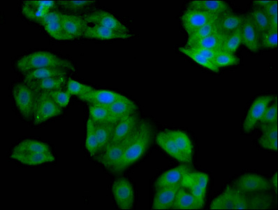 SRP14 Antibody - Immunofluorescence staining of HepG2 cells diluted at 1:133, counter-stained with DAPI. The cells were fixed in 4% formaldehyde, permeabilized using 0.2% Triton X-100 and blocked in 10% normal Goat Serum. The cells were then incubated with the antibody overnight at 4°C.The Secondary antibody was Alexa Fluor 488-congugated AffiniPure Goat Anti-Rabbit IgG (H+L).