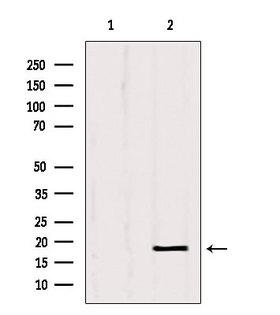 SRP14 Antibody - Western blot analysis of extracts of HeLa cells using SRP14 antibody. Lane 1 was treated with the blocking peptide.