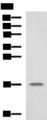 SRP14 Antibody - Western blot analysis of A375 cell lysate  using SRP14 Polyclonal Antibody at dilution of 1:1350