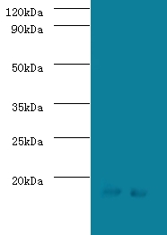 SRP19 Antibody - Western blot of Signal recognition particle 19 KDa protein antibody at 2 ug/ml lane 1: Jurkat whole cell lysate lane 2: HeLa whole cell lysate. Secondary: Goat polyclonal to Rabbit lgG at 1:15000 dilution. Predicted band size: 16 KDa. Observed band size: 16 KDa.  This image was taken for the unconjugated form of this product. Other forms have not been tested.