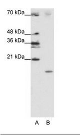 SRP19 Antibody - A: Marker, B: Jurkat Cell Lysate.  This image was taken for the unconjugated form of this product. Other forms have not been tested.