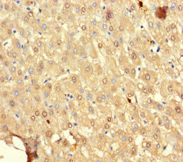 SRP19 Antibody - Immunohistochemistry of paraffin-embedded human liver tissue using SRP19 Antibody at dilution of 1:100