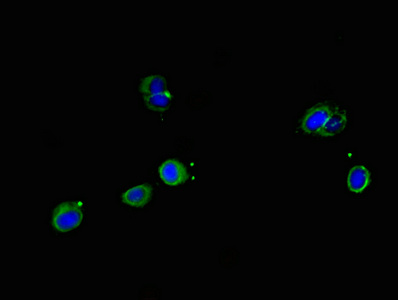 SRP19 Antibody - Immunofluorescent analysis of Hela cells using SRP19 Antibody at dilution of 1:100 and Alexa Fluor 488-congugated AffiniPure Goat Anti-Rabbit IgG(H+L)