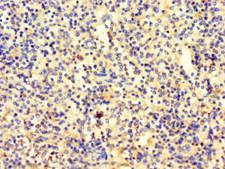 SRP19 Antibody - Immunohistochemistry of paraffin-embedded human spleen tissue using SRP19 Antibody at dilution of 1:100