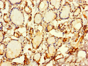 SRP19 Antibody - Immunohistochemistry of paraffin-embedded human thyroid tissue using SRP19 Antibody at dilution of 1:100