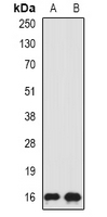 SRP19 Antibody - Western blot analysis of SRP19 expression in HepG2 (A); MCF7 (B) whole cell lysates.