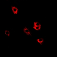 SRP19 Antibody - Immunofluorescent analysis of SRP19 staining in HeLa cells. Formalin-fixed cells were permeabilized with 0.1% Triton X-100 in TBS for 5-10 minutes and blocked with 3% BSA-PBS for 30 minutes at room temperature. Cells were probed with the primary antibody in 3% BSA-PBS and incubated overnight at 4 deg C in a humidified chamber. Cells were washed with PBST and incubated with a DyLight 594-conjugated secondary antibody (red) in PBS at room temperature in the dark.