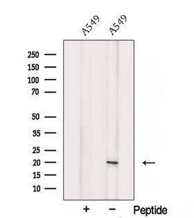 SRP19 Antibody - Western blot analysis of extracts of A549 cells using SRP19 antibody. The lane on the left was treated with blocking peptide.