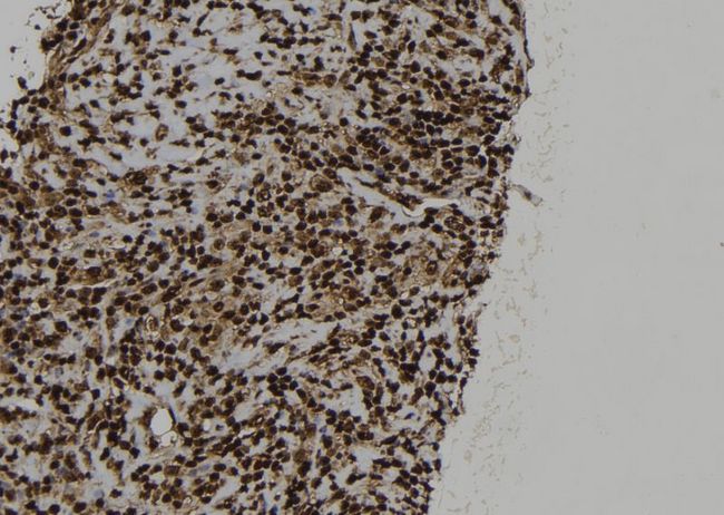 SRP54 Antibody - 1:100 staining human spleen tissue by IHC-P. The sample was formaldehyde fixed and a heat mediated antigen retrieval step in citrate buffer was performed. The sample was then blocked and incubated with the antibody for 1.5 hours at 22°C. An HRP conjugated goat anti-rabbit antibody was used as the secondary.