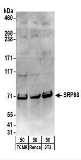 SRP68 Antibody - Detection of Mouse SRP68 by Western Blot. Samples: Whole cell lysate (50 ug) from TCMK-1, Renca, and NIH3T3 cells. Antibodies: Affinity purified rabbit anti-SRP68 antibody used for WB at 0.1 ug/ml. Detection: Chemiluminescence with an exposure time of 30 seconds.