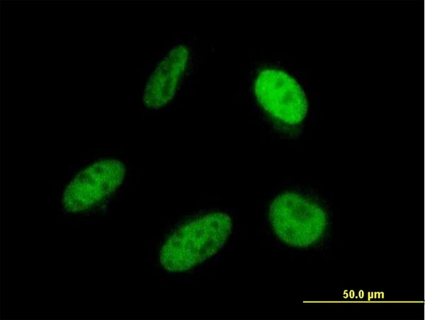 SRP68 Antibody - Immunofluorescence of monoclonal antibody to SRP68 on HeLa cell . [antibody concentration 10 ug/ml]