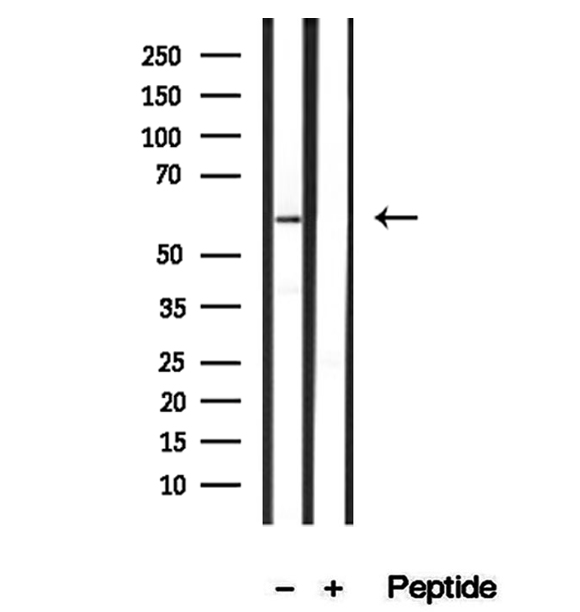 SRP68 Antibody - Western blot analysis of extracts of human kidney tissue using SRP68 antibody.