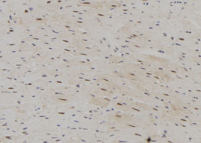SRP68 Antibody - 1:100 staining rat heart tissue by IHC-P. The sample was formaldehyde fixed and a heat mediated antigen retrieval step in citrate buffer was performed. The sample was then blocked and incubated with the antibody for 1.5 hours at 22°C. An HRP conjugated goat anti-rabbit antibody was used as the secondary.