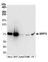 SRP72 Antibody - Detection of human and mouse SRP72 by western blot. Samples: Whole cell lysate (50 µg) from HeLa, HEK293T, Jurkat, mouse TCMK-1, and mouse NIH 3T3 cells prepared using NETN lysis buffer. Antibodies: Affinity purified rabbit anti-SRP72 antibody used for WB at 0.1 µg/ml. Detection: Chemiluminescence with an exposure time of 30 seconds.