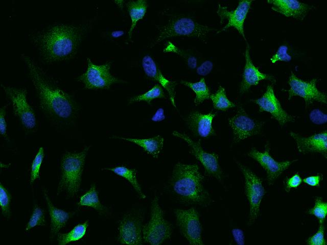 SRP72 Antibody - Immunofluorescence staining of SRP72 in Hela cells. Cells were fixed with 4% PFA, blocked with 10% serum, and incubated with rabbit anti-Human SRP72 polyclonal antibody (dilution ratio 1:100) at 4°C overnight. Then cells were stained with the Alexa Fluor 488-conjugated Goat Anti-rabbit IgG secondary antibody (green) and counterstained with DAPI (blue). Positive staining was localized to Cytoplasm.
