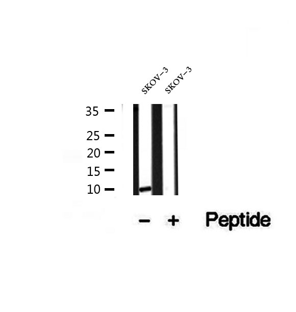 SRP9 Antibody - Western blot analysis of extracts of SK-OV3 cells using SRP9 antibody.