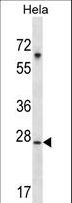 SRPK1 Antibody - SRPK1 Antibody (M1) western blot of HeLa cell line lysates (35 ug/lane). The SRPK1 antibody detected the SRPK1 protein (arrow).
