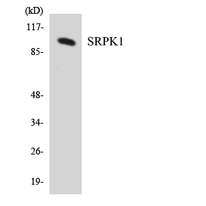 SRPK1 Antibody - Western blot analysis of the lysates from HUVECcells using SRPK1 antibody.