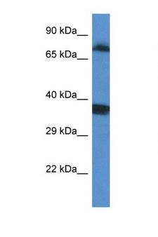 SRPK1 Antibody - SRPK1 antibody Western blot of Fetal Lung lysate. Antibody concentration 1 ug/ml.  This image was taken for the unconjugated form of this product. Other forms have not been tested.