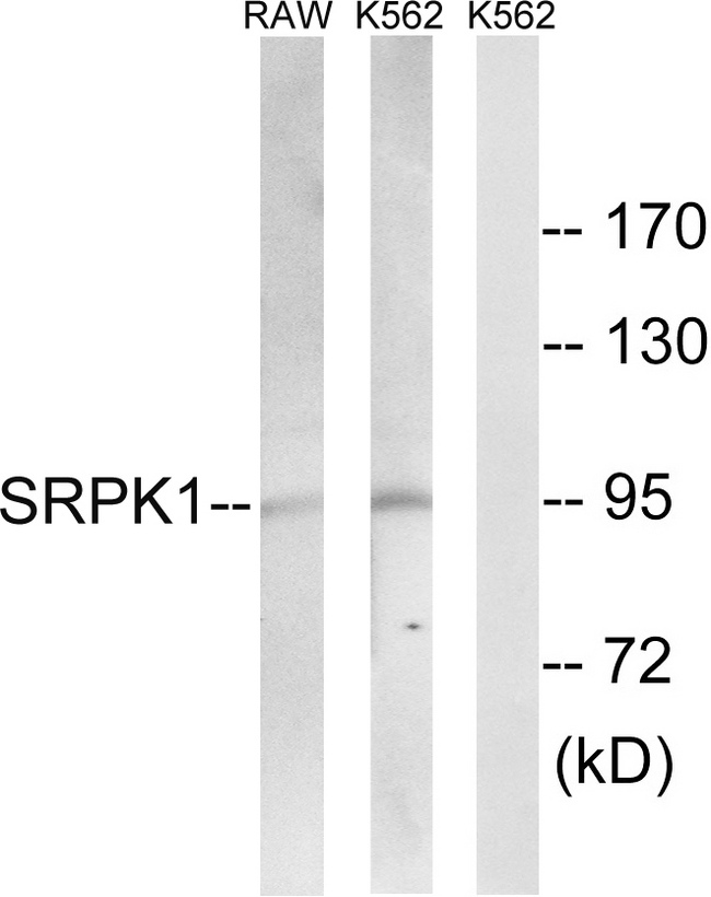 SRPK1 Antibody - Western blot analysis of lysates from K562 and RAW264.7 cells, using SRPK1 Antibody. The lane on the right is blocked with the synthesized peptide.