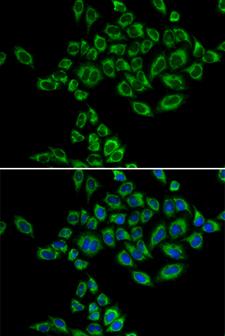SRPK1 Antibody - Immunofluorescence analysis of HeLa cells.