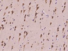 SRPK2 Antibody - Immunochemical staining of human SRPK2 in human brain with rabbit polyclonal antibody at 1:100 dilution, formalin-fixed paraffin embedded sections.