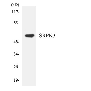 SRPK3 / MSSK1 Antibody - Western blot analysis of the lysates from HeLa cells using SRPK3 antibody.