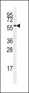 SRPK3 / MSSK1 Antibody - Western blot of anti-MSSK1 antibody in A375 cell lysate. MSSK1 (arrow) was detected using purified antibody. Secondary HRP-anti-rabbit was used for signal visualization with chemiluminescence.