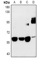 SRPK3 / MSSK1 Antibody - Western blot analysis of SRPK3 expression in PC3 (A), H1792 (B), PC12 (C), mouse heart (D) whole cell lysates.