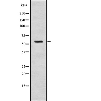 SRPK3 / MSSK1 Antibody - Western blot analysis SRPK3 using MCF-7 whole cells lysates