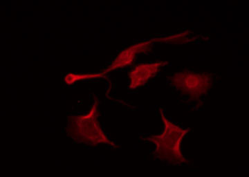 SRPK3 / MSSK1 Antibody - Staining 293T cells by IF/ICC. The samples were fixed with PFA and permeabilized in 0.1% Triton X-100, then blocked in 10% serum for 45 min at 25°C. The primary antibody was diluted at 1:200 and incubated with the sample for 1 hour at 37°C. An Alexa Fluor 594 conjugated goat anti-rabbit IgG (H+L) Ab, diluted at 1/600, was used as the secondary antibody.