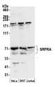 SRPR Antibody - Detection of human SRPRA by western blot. Samples: Whole cell lysate (50 µg) from HeLa, HEK293T, and Jurkat cells prepared using NETN lysis buffer. Antibody: Affinity purified rabbit anti-SRPRA antibody used for WB at 0.1 µg/ml. Detection: Chemiluminescence with an exposure time of 30 seconds.