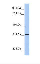 SRPRB Antibody - Hela cell lysate. Antibody concentration: 1.0 ug/ml. Gel concentration: 12%.  This image was taken for the unconjugated form of this product. Other forms have not been tested.