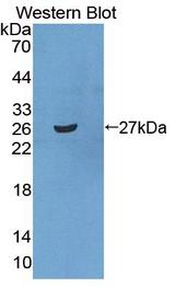 SRPRB Antibody - Western blot of SRPRB antibody.
