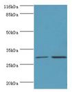 SRPRB Antibody - Western blot. All lanes: SRPRB antibody at 2 ug/ml Lane 1:HepG2 whole cell lysate. Lane 2: HeLa whole cell lysate. Secondary antibody: Goat polyclonal to rabbit at 1:10000 dilution. Predicted band size: 30 kDa. Observed band size: 30 kDa.  This image was taken for the unconjugated form of this product. Other forms have not been tested.