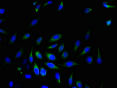 SRPRB Antibody - Immunofluorescent analysis of Hela cells using SRPRB Antibody at dilution of 1:100 and Alexa Fluor 488-congugated AffiniPure Goat Anti-Rabbit IgG(H+L)
