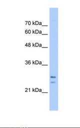 SRPRB Antibody - HepG2 cell lysate. Antibody concentration: 5.0 ug/ml. Gel concentration: 12%.  This image was taken for the unconjugated form of this product. Other forms have not been tested.