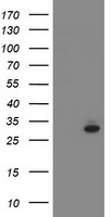 SRPRB Antibody - HEK293T cells were transfected with the pCMV6-ENTRY control (Left lane) or pCMV6-ENTRY SRPRB (Right lane) cDNA for 48 hrs and lysed. Equivalent amounts of cell lysates (5 ug per lane) were separated by SDS-PAGE and immunoblotted with anti-SRPRB.