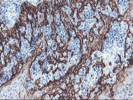 SRPRB Antibody - IHC of paraffin-embedded Human tonsil using anti-SRPRB mouse monoclonal antibody.