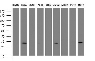 SRPRB Antibody - Western blot of extracts (35ug) from 9 different cell lines by using anti-SRPRB monoclonal antibody (HepG2: human; HeLa: human; SVT2: mouse; A549: human; COS7: monkey; Jurkat: human; MDCK: canine; PC12: rat; MCF7: human).