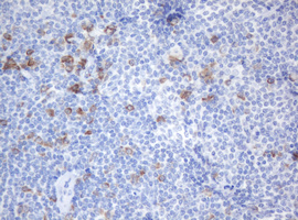 SRPRB Antibody - IHC of paraffin-embedded Human lymphoma tissue using anti-SRPRB mouse monoclonal antibody. (Heat-induced epitope retrieval by 10mM citric buffer, pH6.0, 120°C for 3min).
