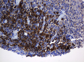 SRPRB Antibody - IHC of paraffin-embedded Human tonsil using anti-SRPRB mouse monoclonal antibody. (Heat-induced epitope retrieval by 10mM citric buffer, pH6.0, 120°C for 3min).