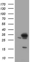 SRPRB Antibody - HEK293T cells were transfected with the pCMV6-ENTRY control (Left lane) or pCMV6-ENTRY SRPRB (Right lane) cDNA for 48 hrs and lysed. Equivalent amounts of cell lysates (5 ug per lane) were separated by SDS-PAGE and immunoblotted with anti-SRPRB.